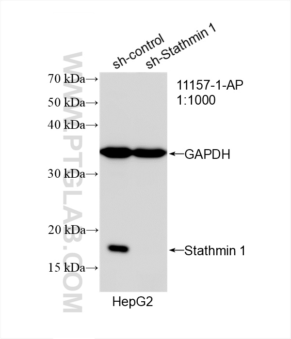 Western Blot (WB) analysis of HepG2 cells using Stathmin 1 Polyclonal antibody (11157-1-AP)