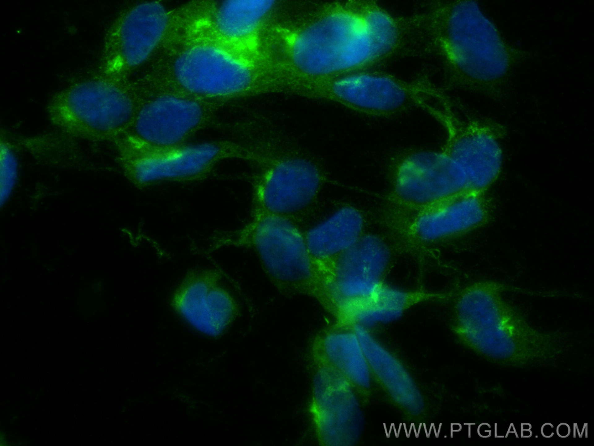 Immunofluorescence (IF) / fluorescent staining of SH-SY5Y cells using STMN2 Polyclonal antibody (10586-1-AP)