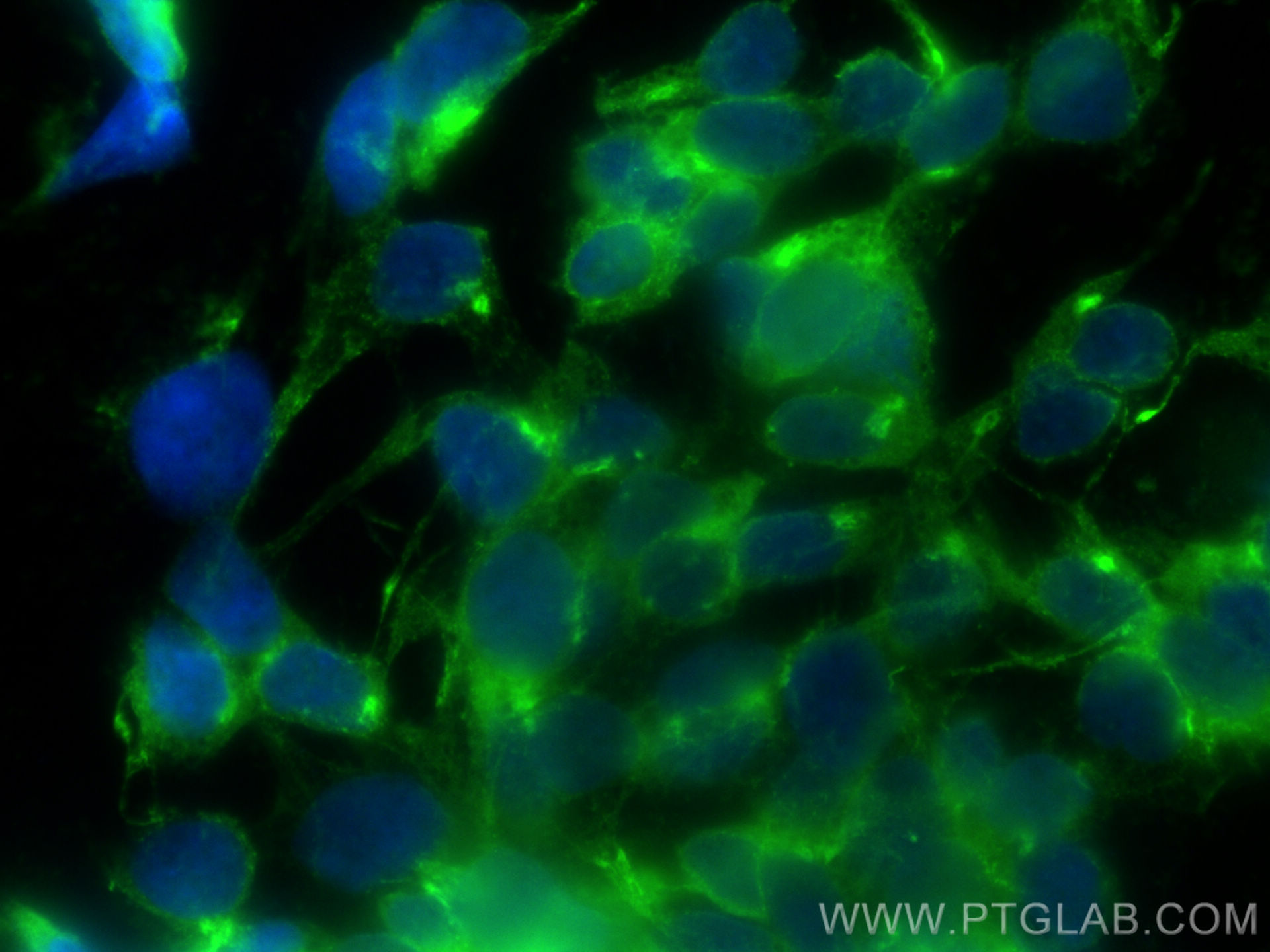 Immunofluorescence (IF) / fluorescent staining of SH-SY5Y cells using STMN2 Polyclonal antibody (10586-1-AP)