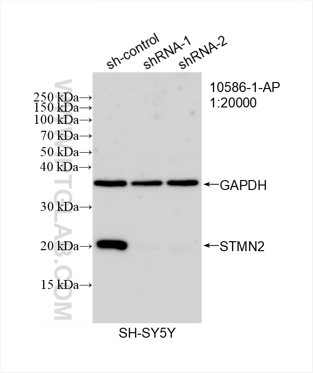 Western Blot (WB) analysis of SH-SY5Y cells using STMN2 Polyclonal antibody (10586-1-AP)