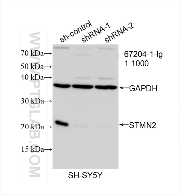 Western Blot (WB) analysis of SH-SY5Y cells using STMN2 Monoclonal antibody (67204-1-Ig)