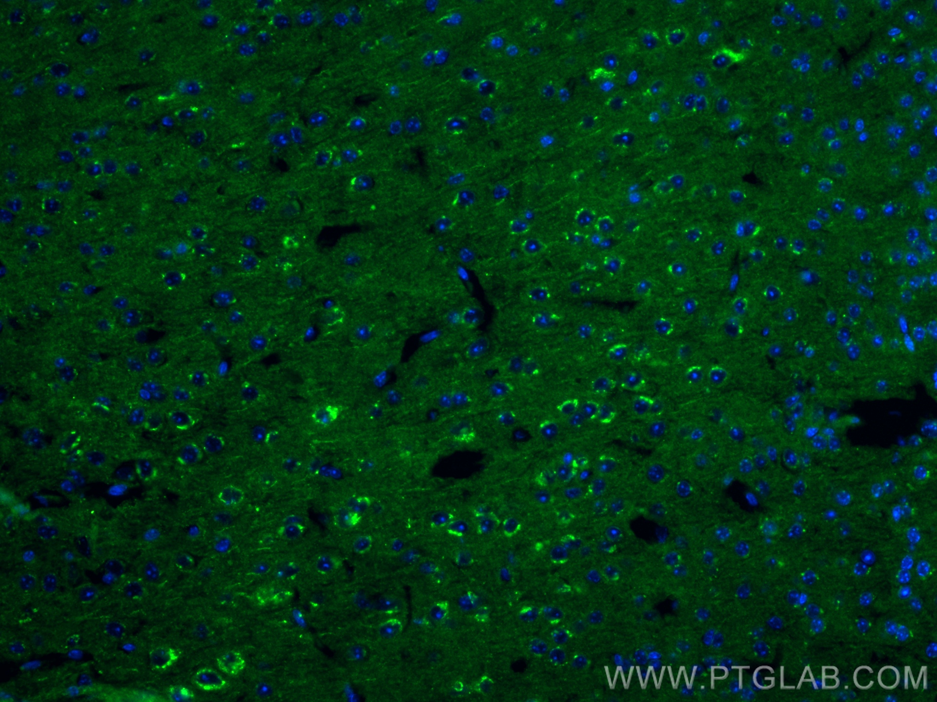 Immunofluorescence (IF) / fluorescent staining of mouse brain tissue using STMN2 Recombinant antibody (82925-1-RR)