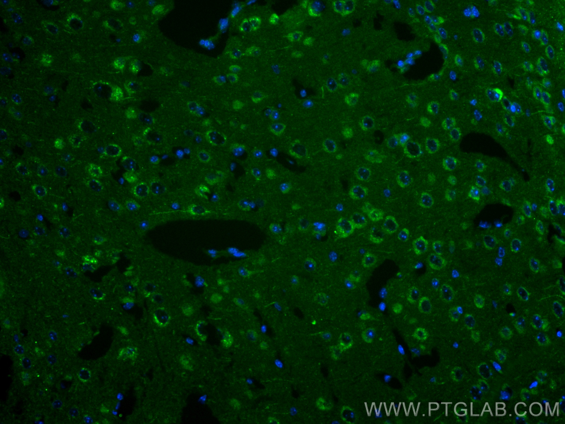 Immunofluorescence (IF) / fluorescent staining of mouse brain tissue using STMN2 Recombinant antibody (82925-2-RR)