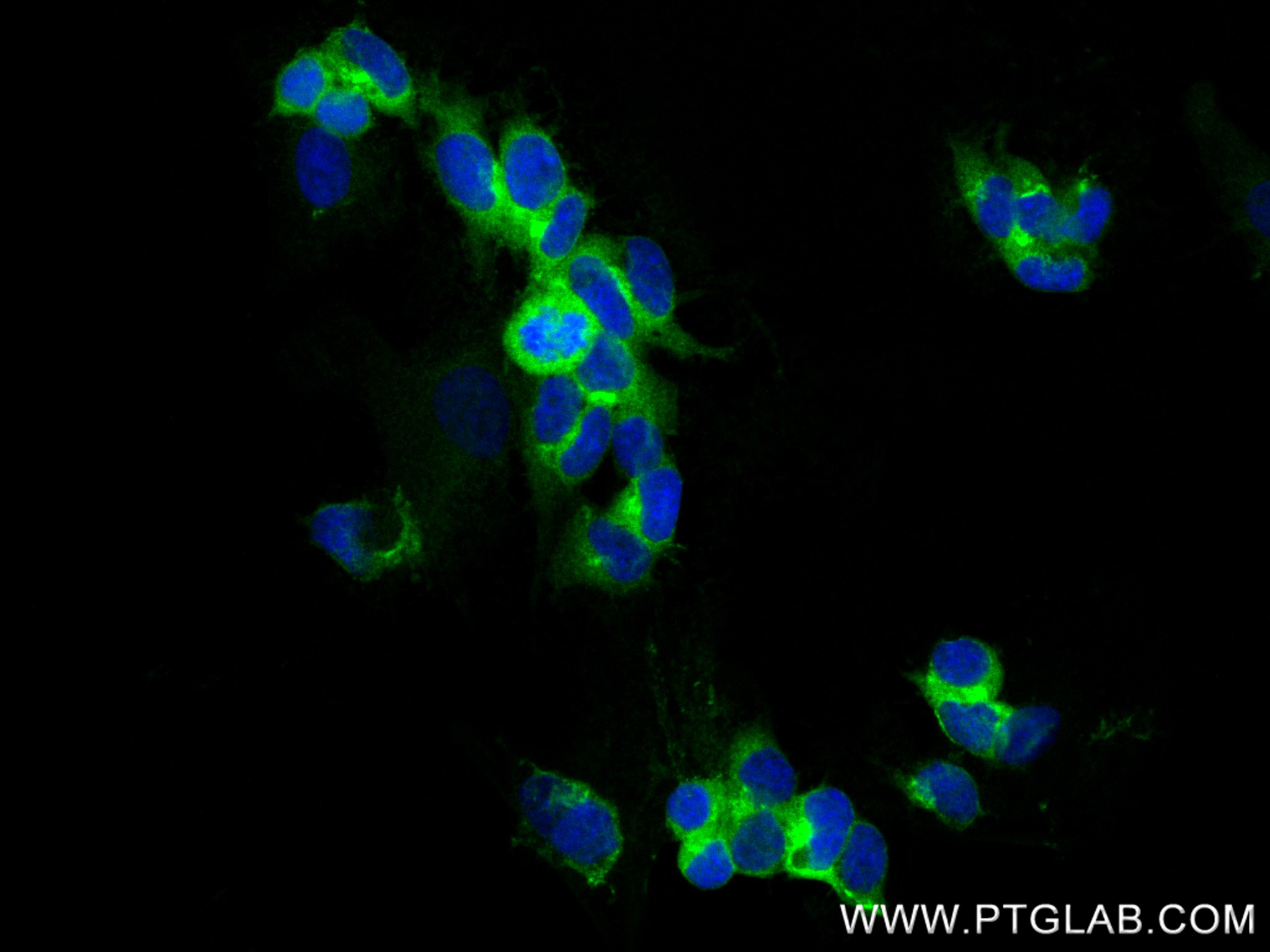 Immunofluorescence (IF) / fluorescent staining of SH-SY5Y cells using STMN2 Recombinant antibody (82925-3-RR)