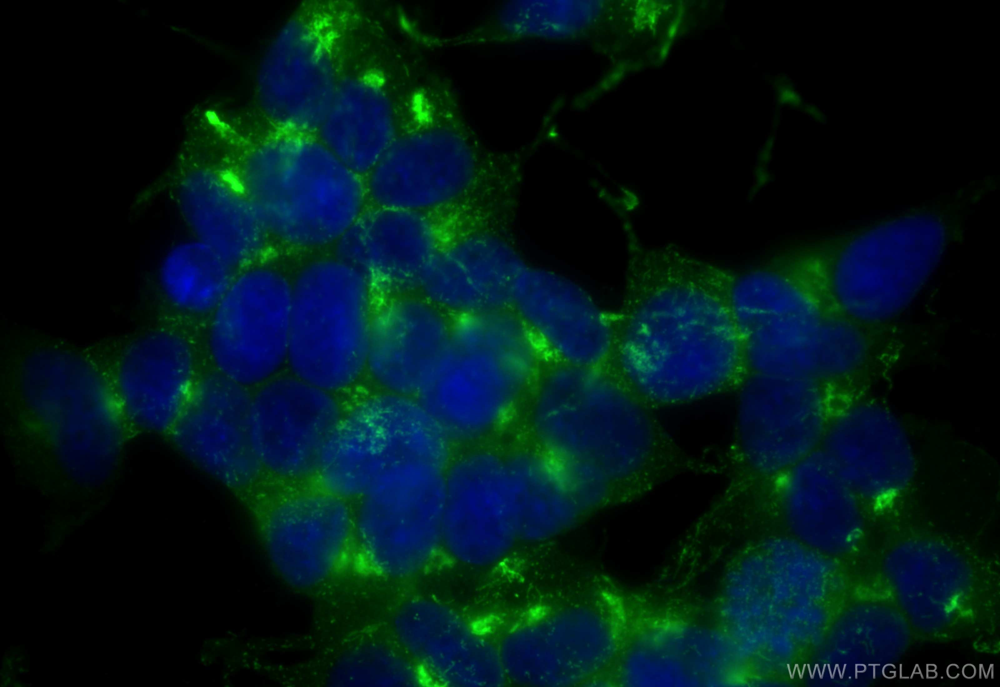 Immunofluorescence (IF) / fluorescent staining of SH-SY5Y cells using CoraLite® Plus 488-conjugated STMN2 Polyclonal ant (CL488-10586)