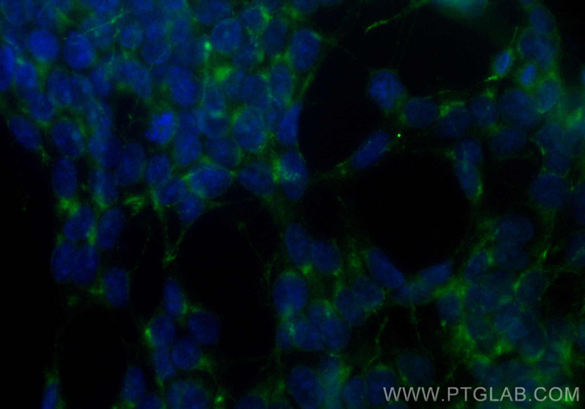 Immunofluorescence (IF) / fluorescent staining of SH-SY5Y cells using CoraLite® Plus 488-conjugated STMN2 Recombinant an (CL488-82925-2)