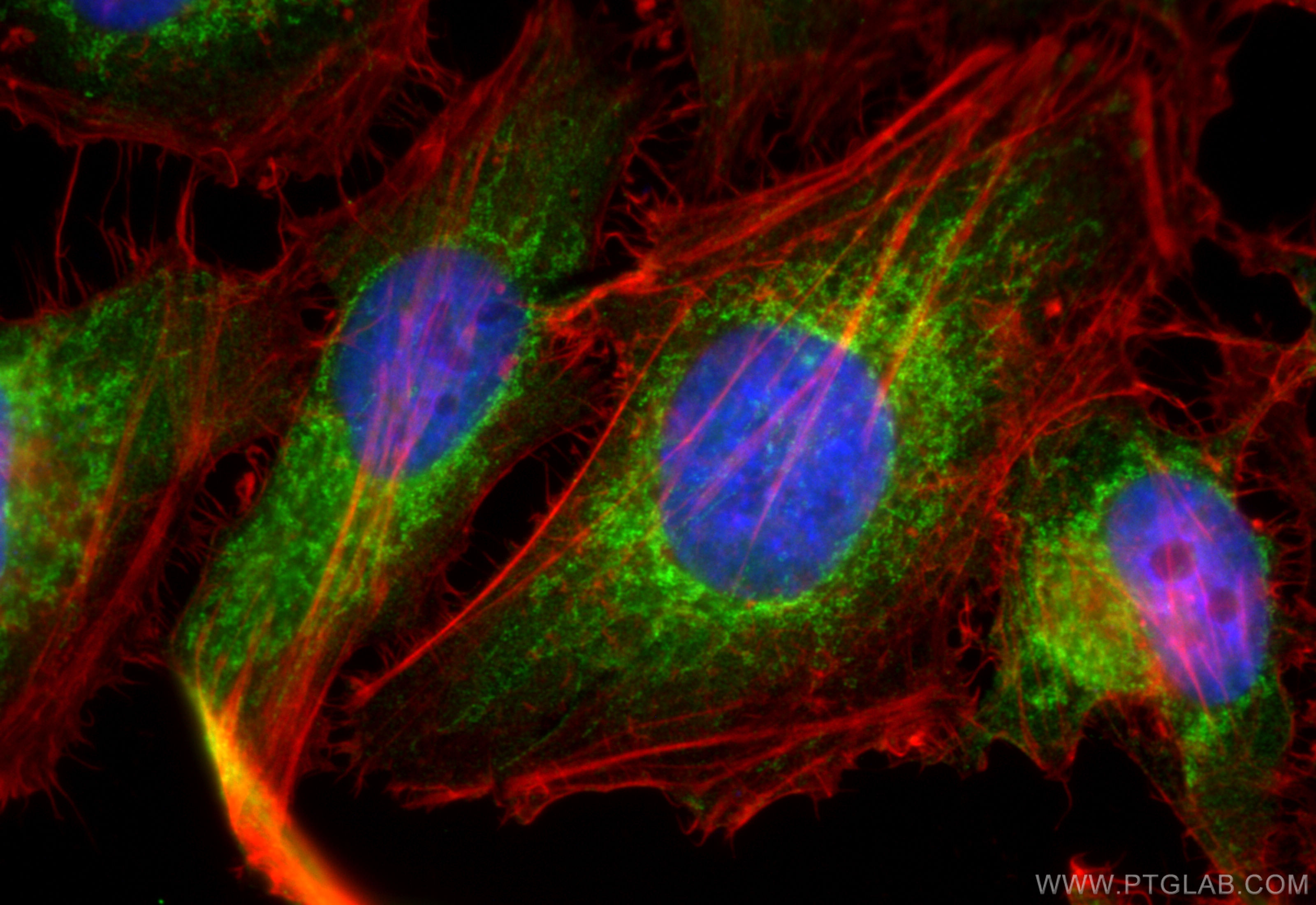 Immunofluorescence (IF) / fluorescent staining of HeLa cells using STOML2 Polyclonal antibody (10348-1-AP)