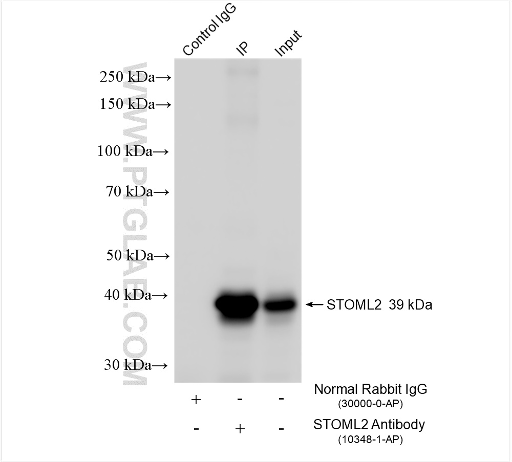 Immunoprecipitation (IP) experiment of mouse brain tissue using STOML2 Polyclonal antibody (10348-1-AP)