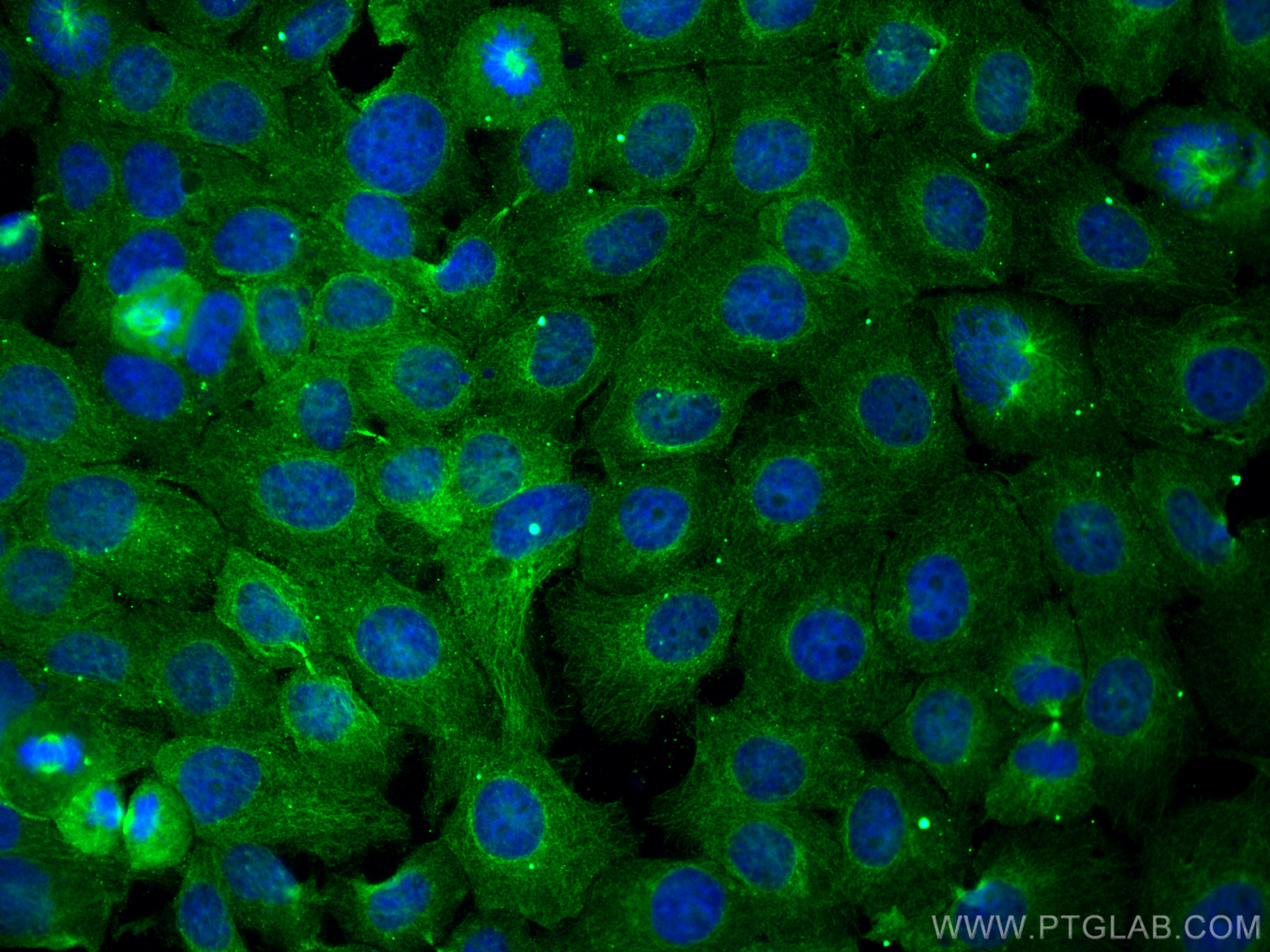 Immunofluorescence (IF) / fluorescent staining of A431 cells using STOML2 Monoclonal antibody (60052-1-Ig)