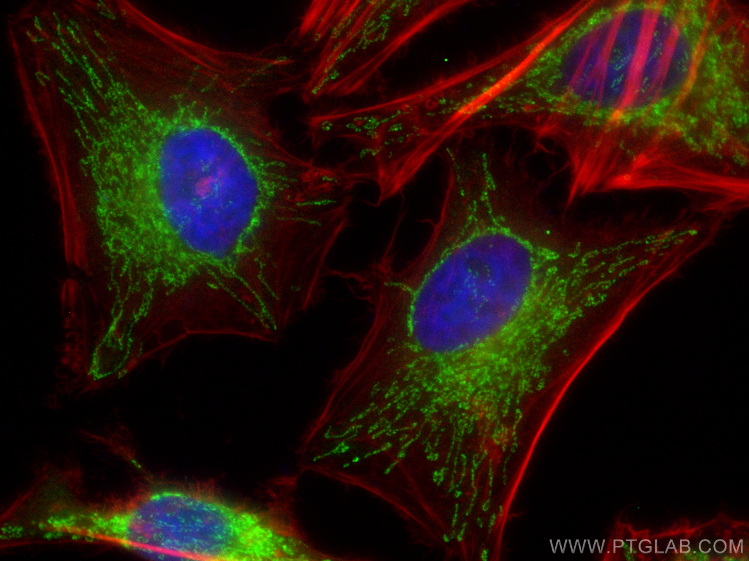 Immunofluorescence (IF) / fluorescent staining of HeLa cells using CoraLite® Plus 488-conjugated STOML2 Polyclonal an (CL488-10348)