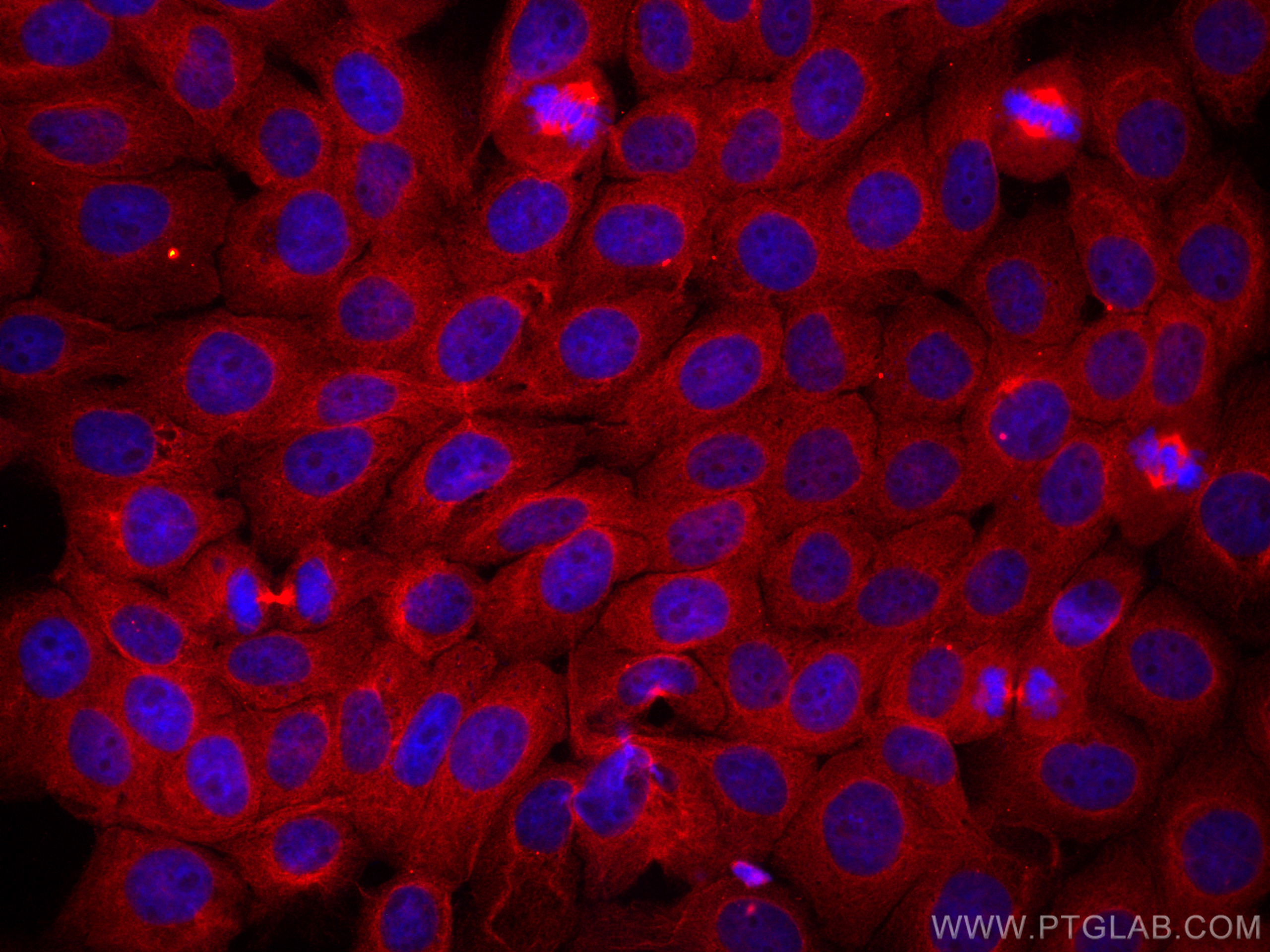 Immunofluorescence (IF) / fluorescent staining of A431 cells using CoraLite®594-conjugated STOML2 Monoclonal antibody (CL594-60052)