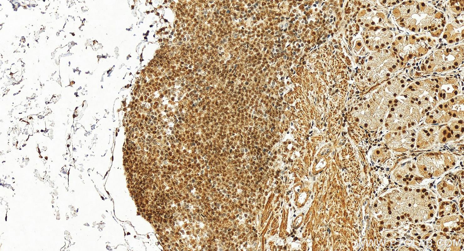 Immunohistochemistry (IHC) staining of human stomach tissue using STRBP Polyclonal antibody (17362-1-AP)