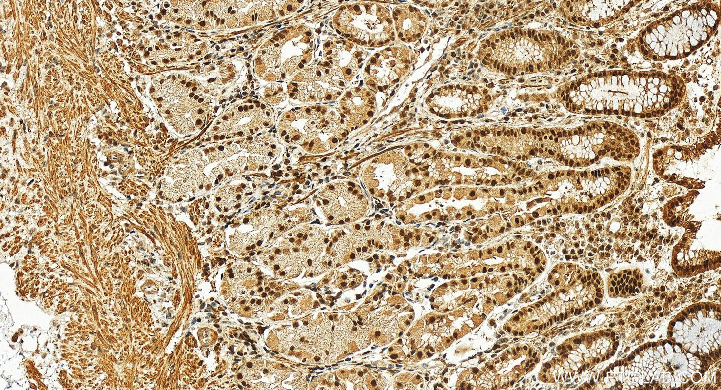 Immunohistochemistry (IHC) staining of human stomach tissue using STRBP Polyclonal antibody (17362-1-AP)