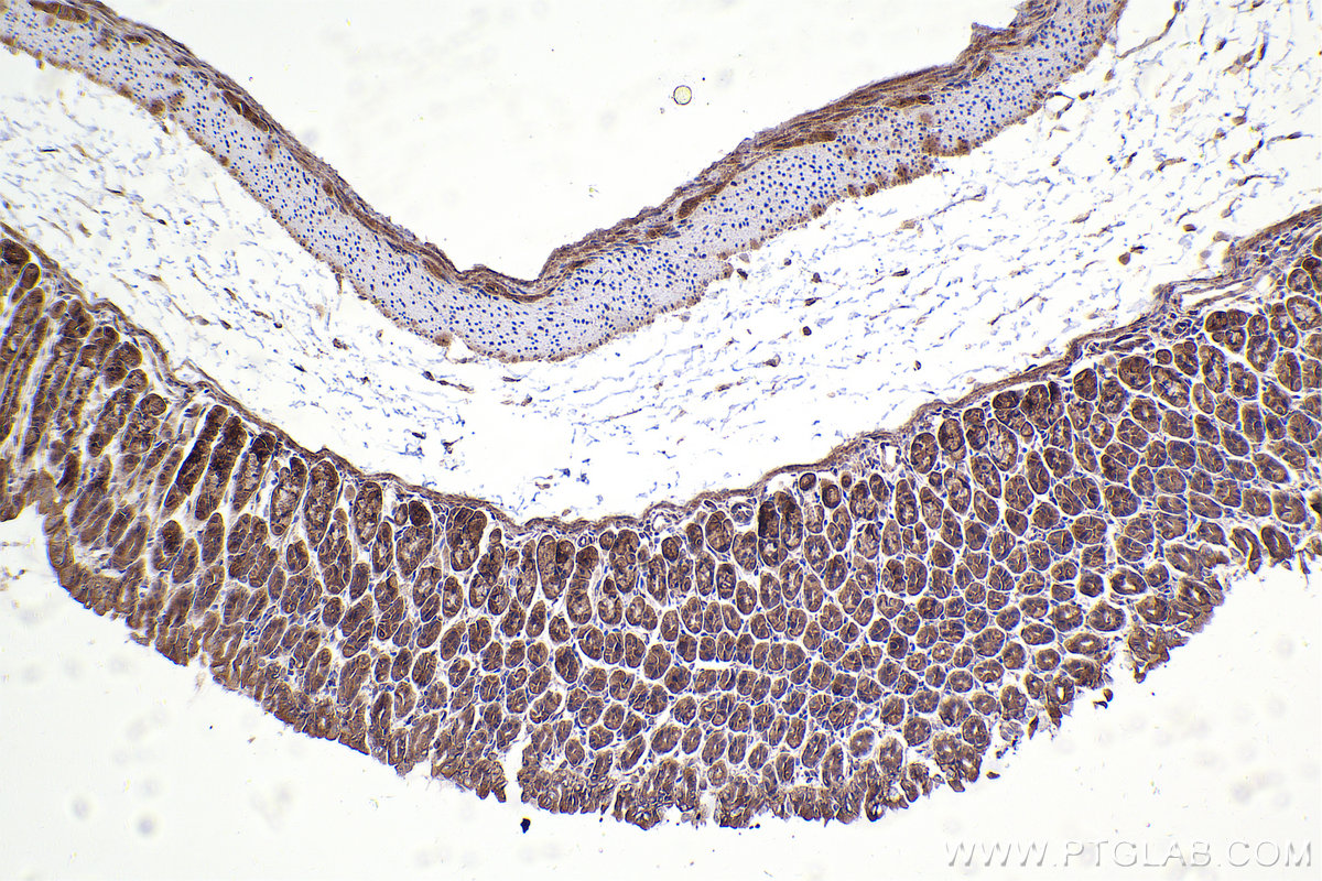 Immunohistochemistry (IHC) staining of mouse stomach tissue using STRN3 Polyclonal antibody (23966-1-AP)