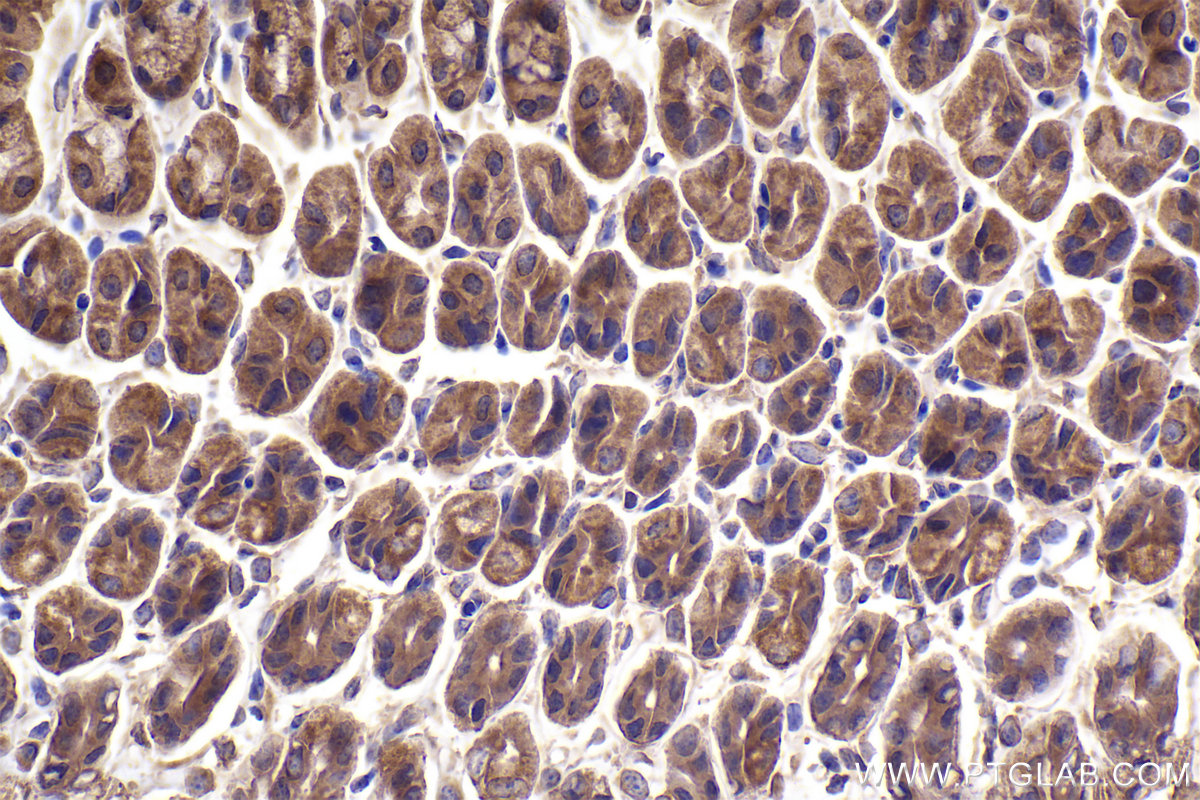 Immunohistochemistry (IHC) staining of mouse stomach tissue using STRN3 Polyclonal antibody (23966-1-AP)