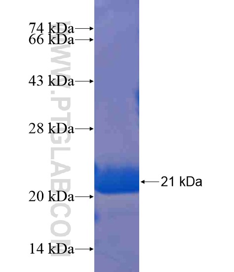 STRN3 fusion protein Ag21098 SDS-PAGE