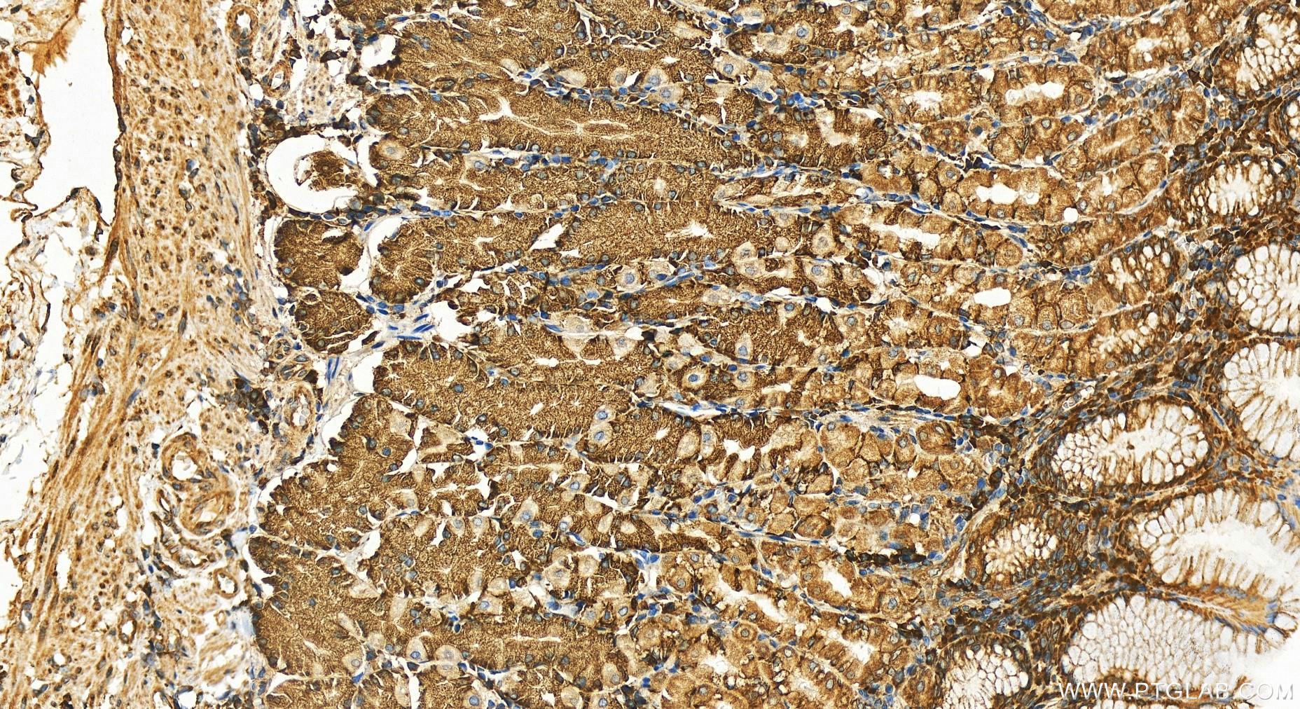 Immunohistochemistry (IHC) staining of human stomach tissue using STT3A Polyclonal antibody (12034-1-AP)