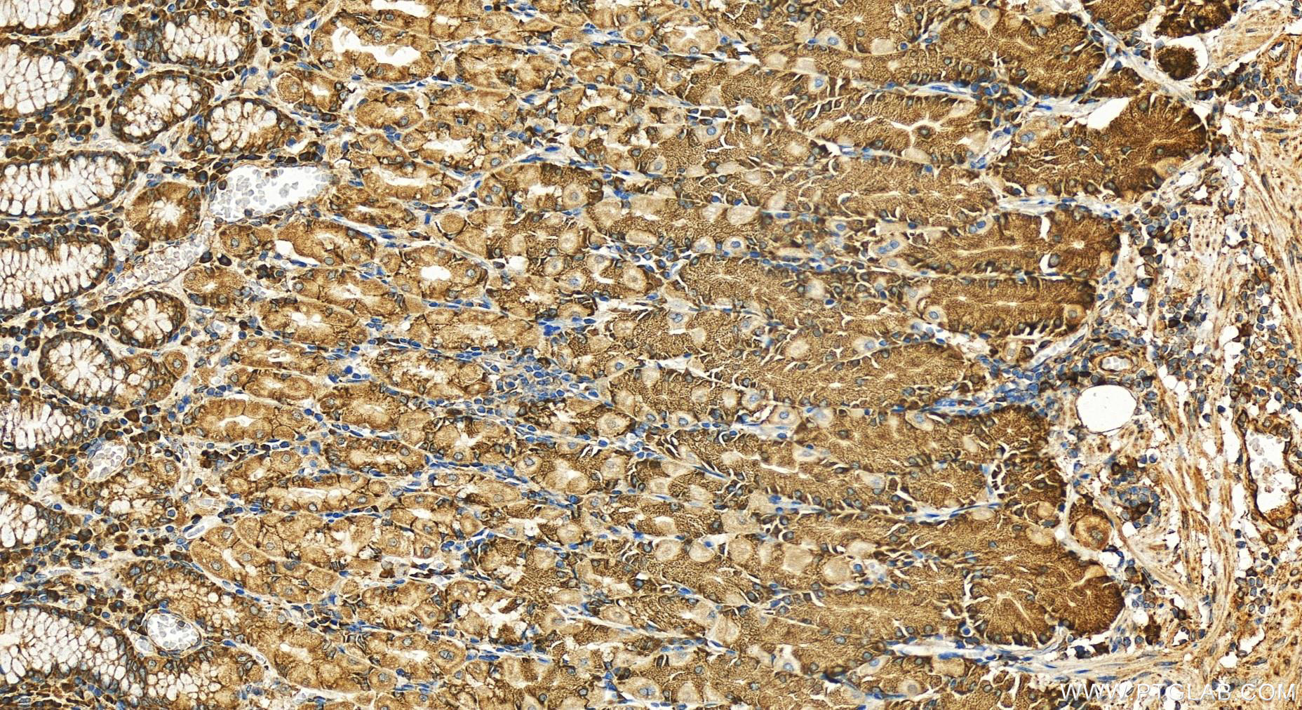 Immunohistochemistry (IHC) staining of human stomach tissue using STT3A Polyclonal antibody (12034-1-AP)