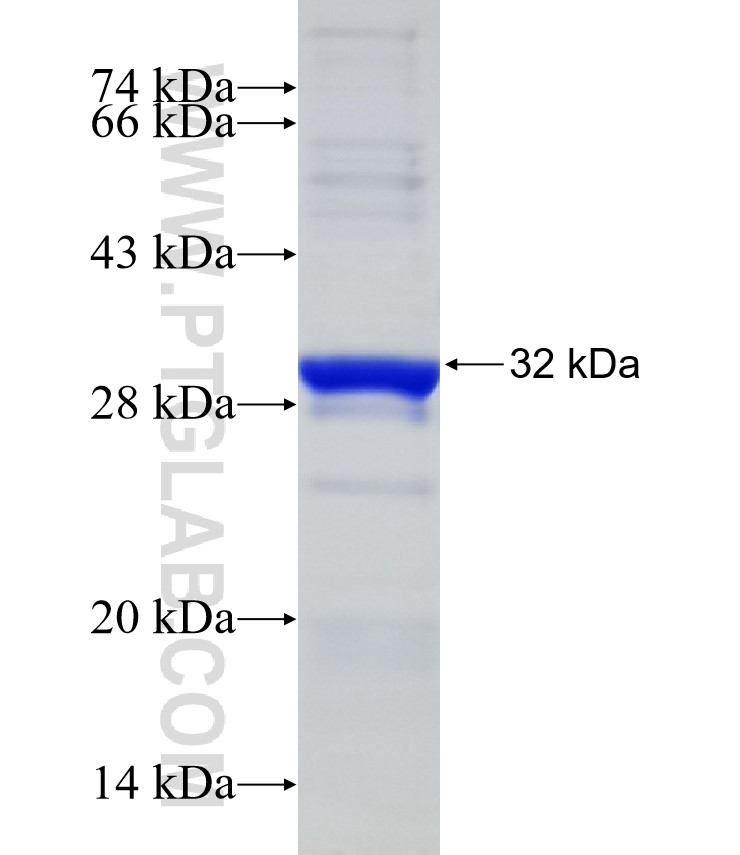 STT3A fusion protein Ag31994 SDS-PAGE