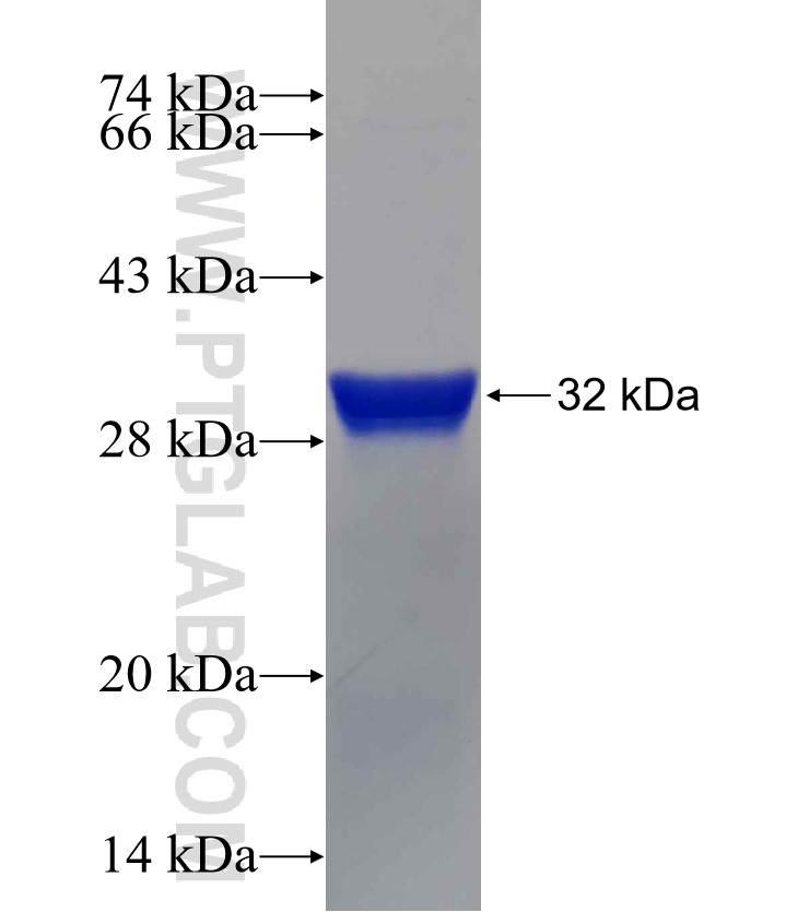 STT3B fusion protein Ag30857 SDS-PAGE