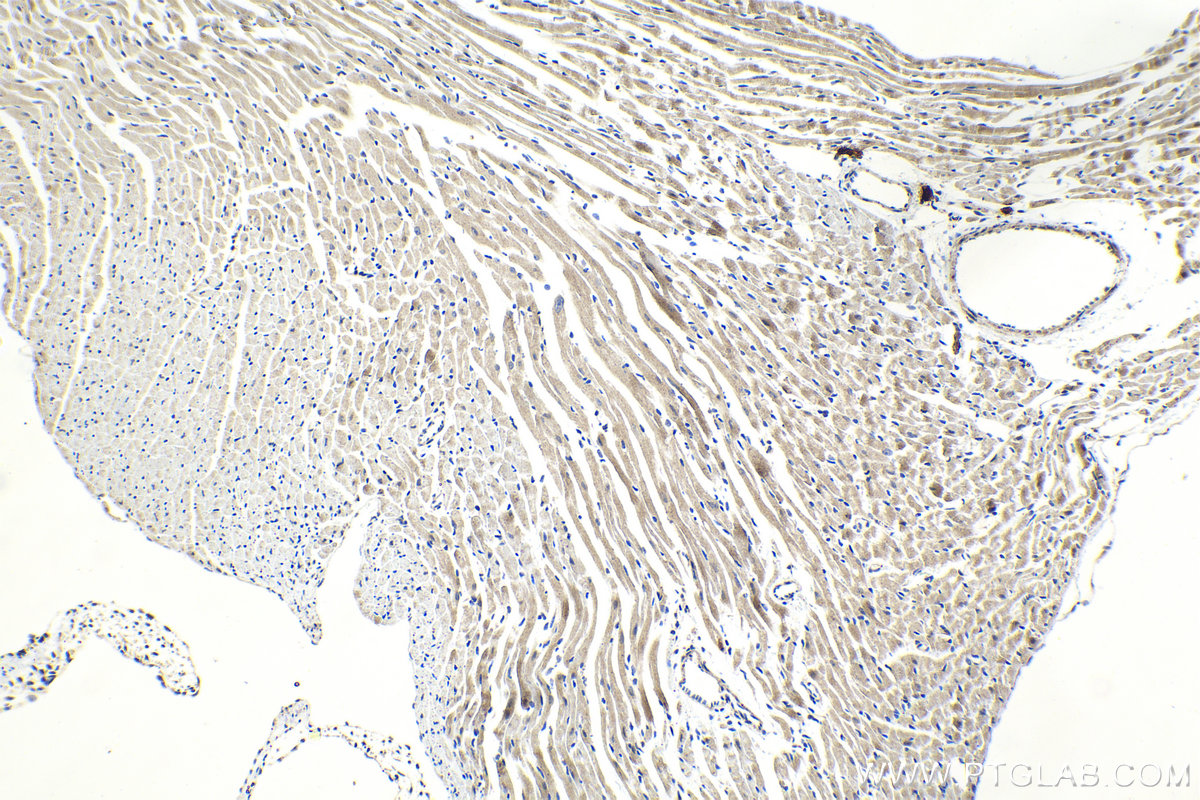 Immunohistochemistry (IHC) staining of mouse heart tissue using Syntaxin 10 Polyclonal antibody (11036-1-AP)