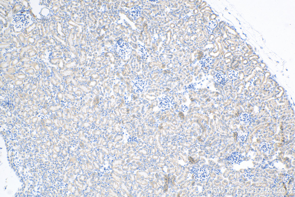 Immunohistochemistry (IHC) staining of mouse kidney tissue using STX17 Recombinant antibody (81899-1-RR)