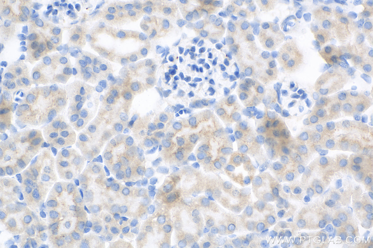 Immunohistochemistry (IHC) staining of mouse kidney tissue using STX17 Recombinant antibody (81899-1-RR)