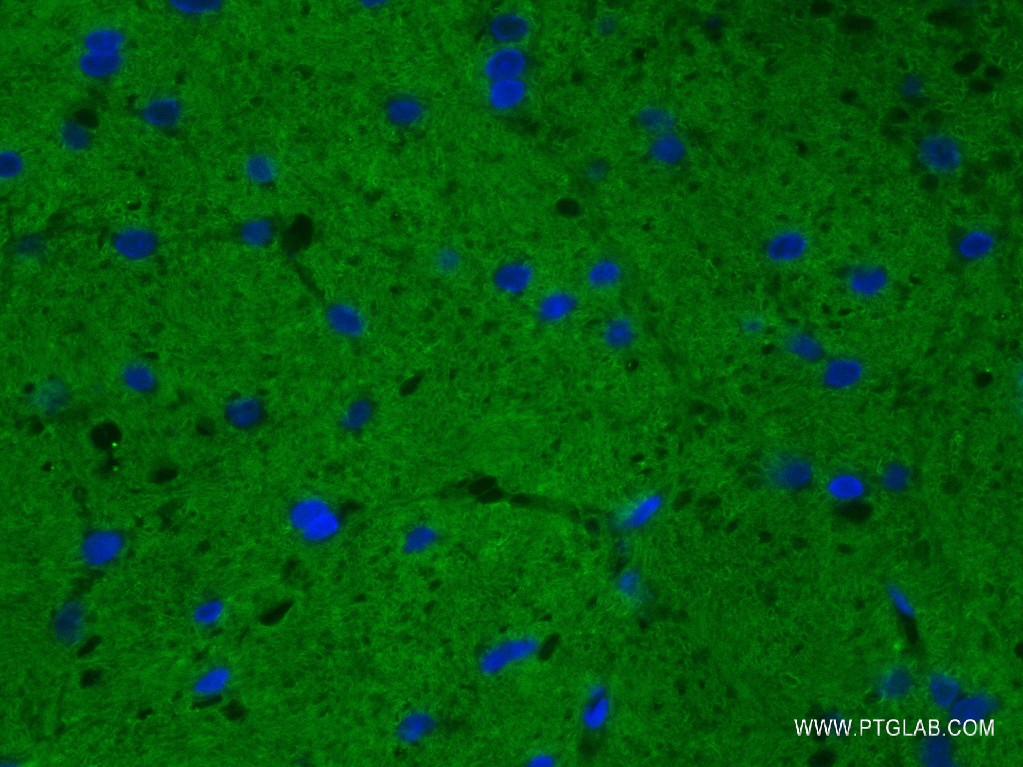 Immunofluorescence (IF) / fluorescent staining of mouse cerebellum tissue using STX1A Recombinant antibody (83159-6-RR)