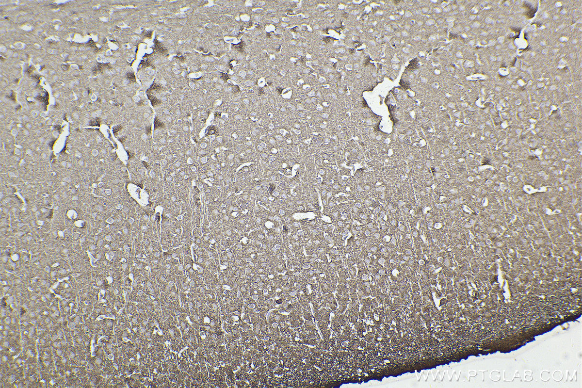 Immunohistochemistry (IHC) staining of mouse brain tissue using STX1A Recombinant antibody (83159-6-RR)