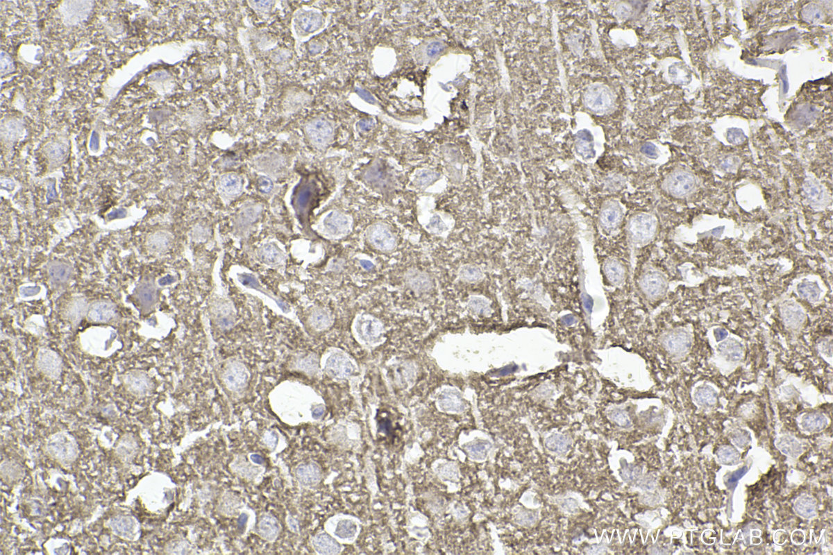 Immunohistochemistry (IHC) staining of mouse brain tissue using STX1A Recombinant antibody (83159-6-RR)