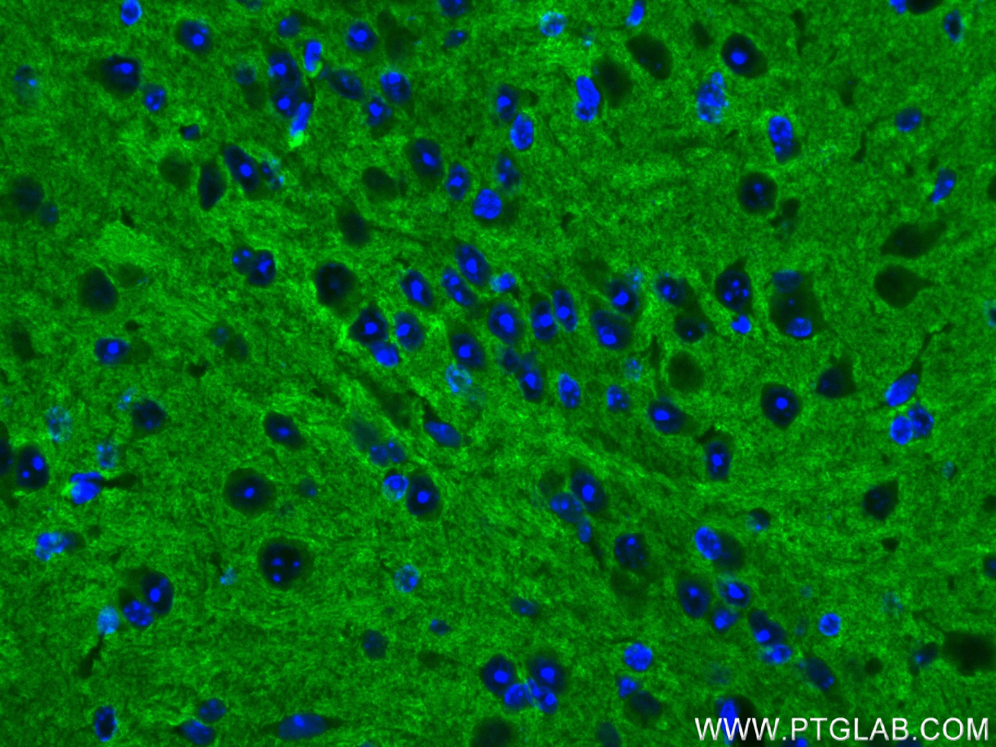 Immunofluorescence (IF) / fluorescent staining of mouse brain tissue using STX1B Recombinant antibody (83298-1-RR)