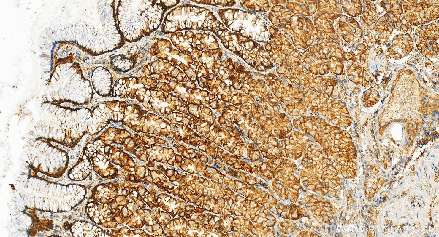 Immunohistochemistry (IHC) staining of human stomach tissue using Syntaxin 4 Polyclonal antibody (14988-1-AP)