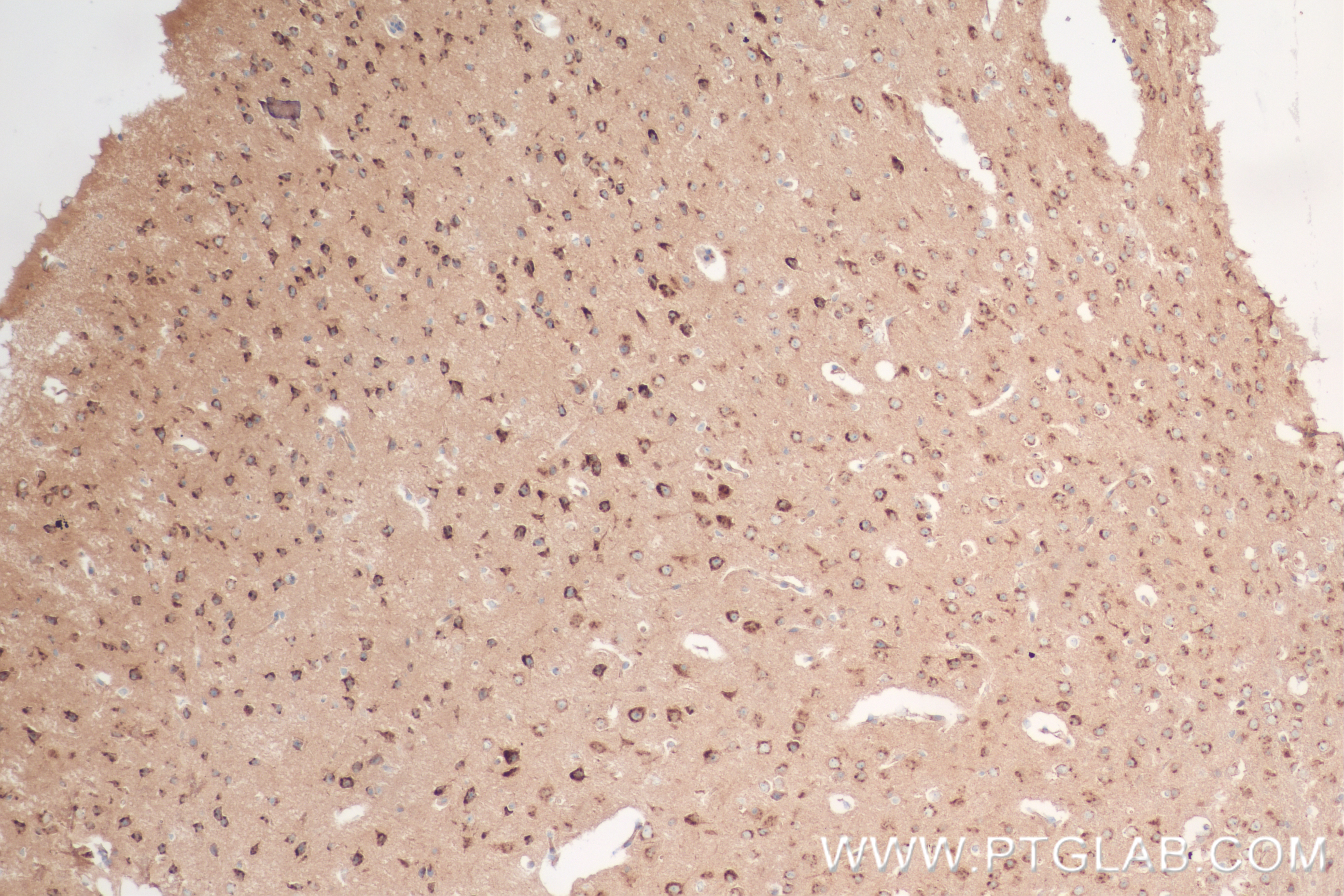 Immunohistochemistry (IHC) staining of mouse brain tissue using Syntaxin 6 Recombinant antibody (84627-5-RR)