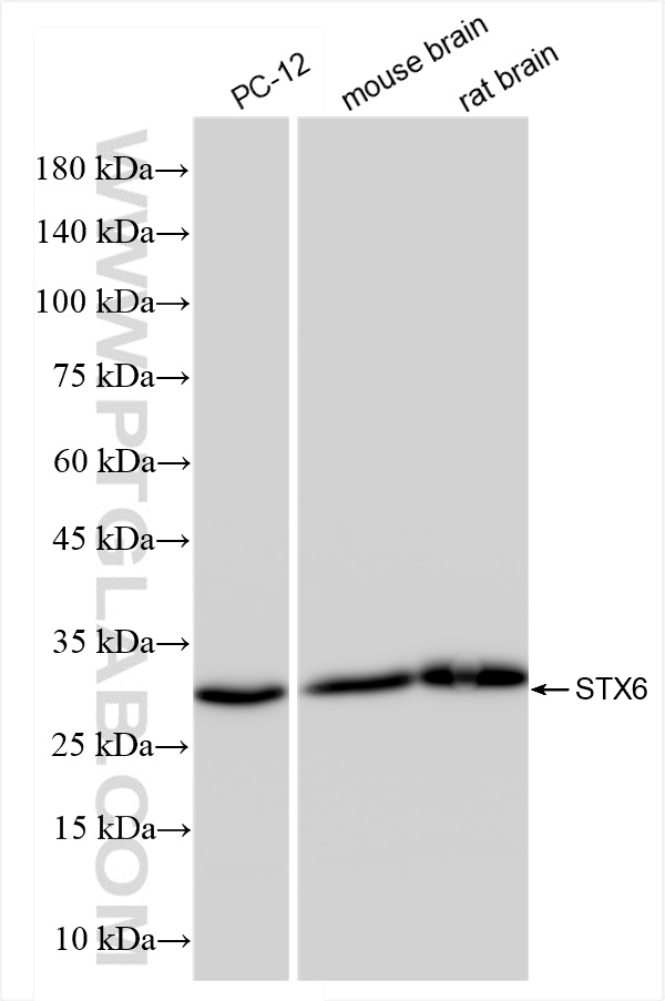 Western Blot (WB) analysis of various lysates using Syntaxin 6 Recombinant antibody (84627-5-RR)