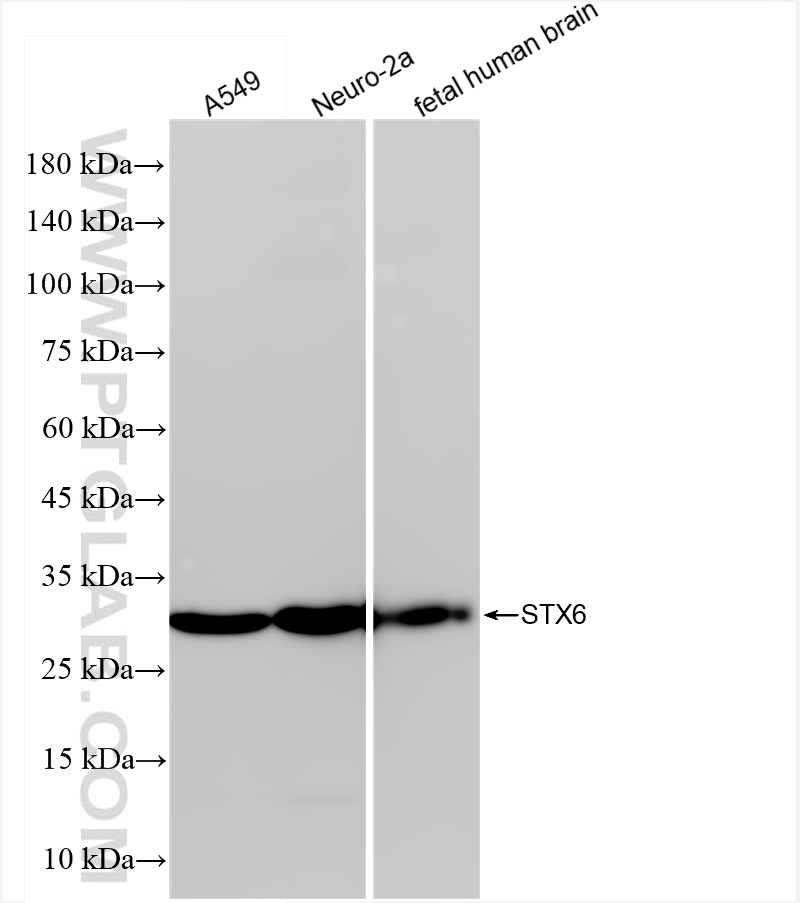 Western Blot (WB) analysis of various lysates using Syntaxin 6 Recombinant antibody (84627-5-RR)