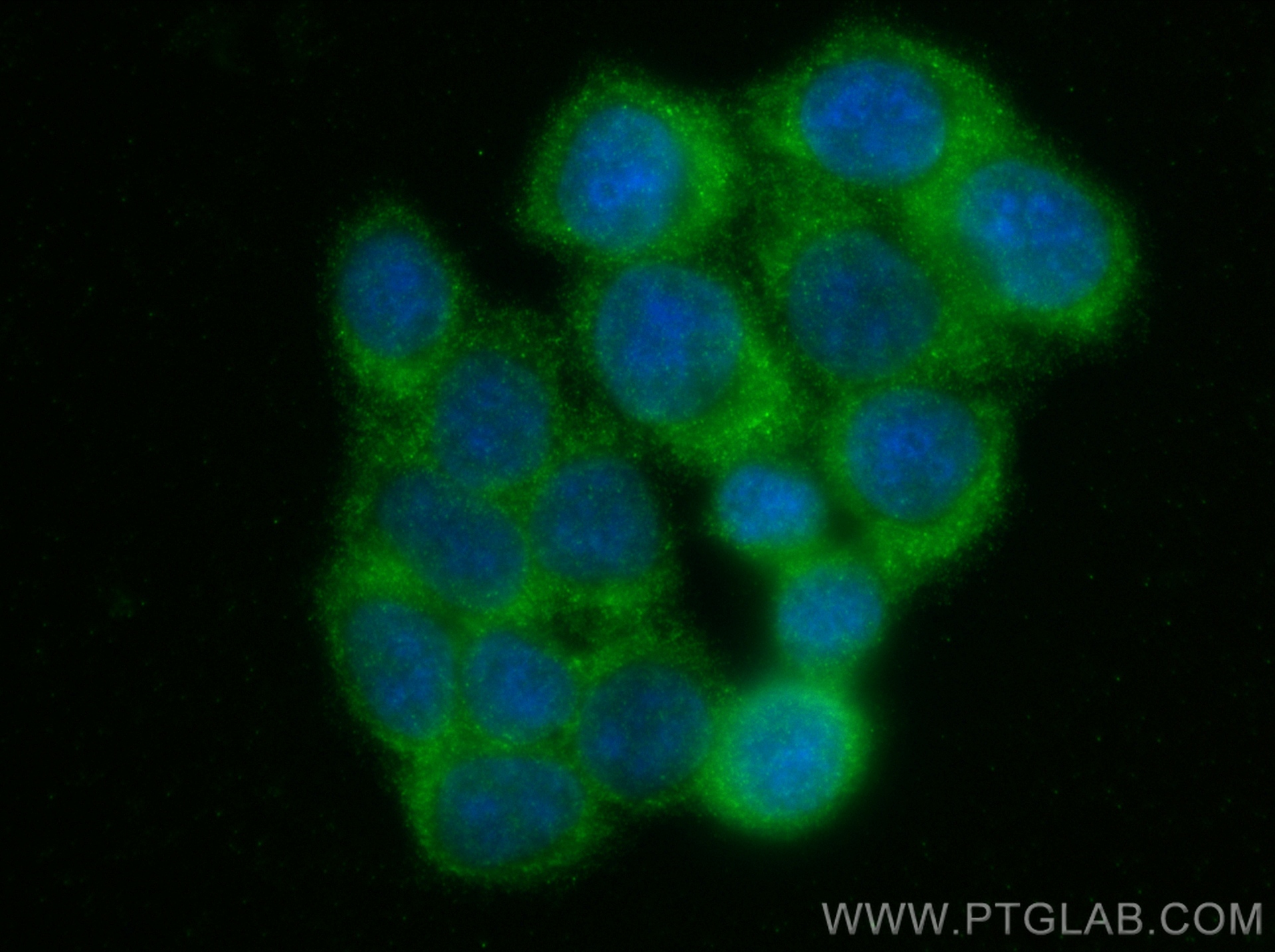 Immunofluorescence (IF) / fluorescent staining of BxPC-3 cells using STXBP4 Polyclonal antibody (14231-1-AP)