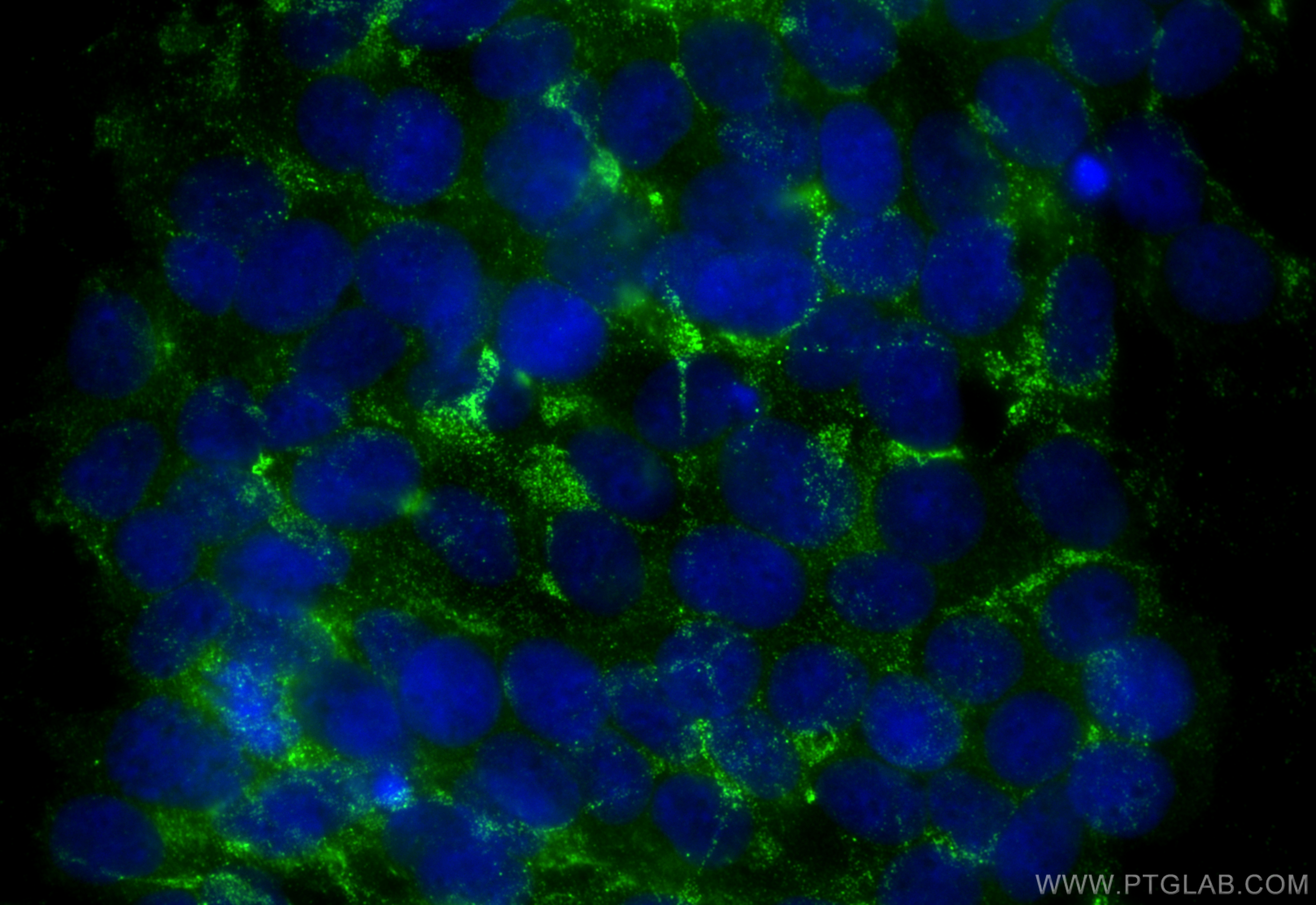 Immunofluorescence (IF) / fluorescent staining of SH-SY5Y cells using STXBP5 Polyclonal antibody (24512-1-AP)