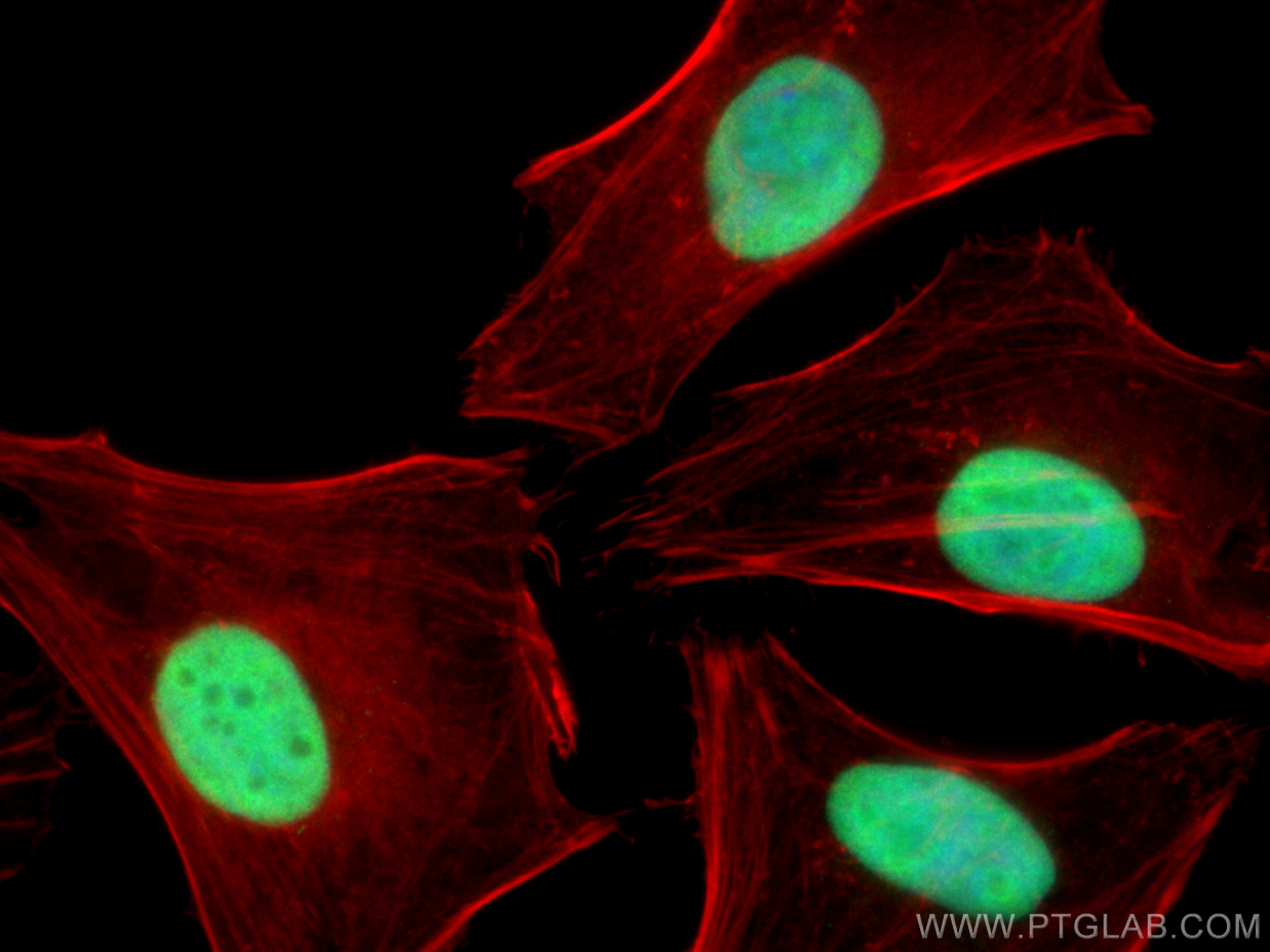 Immunofluorescence (IF) / fluorescent staining of HeLa cells using SUB1 Polyclonal antibody (10948-2-AP)