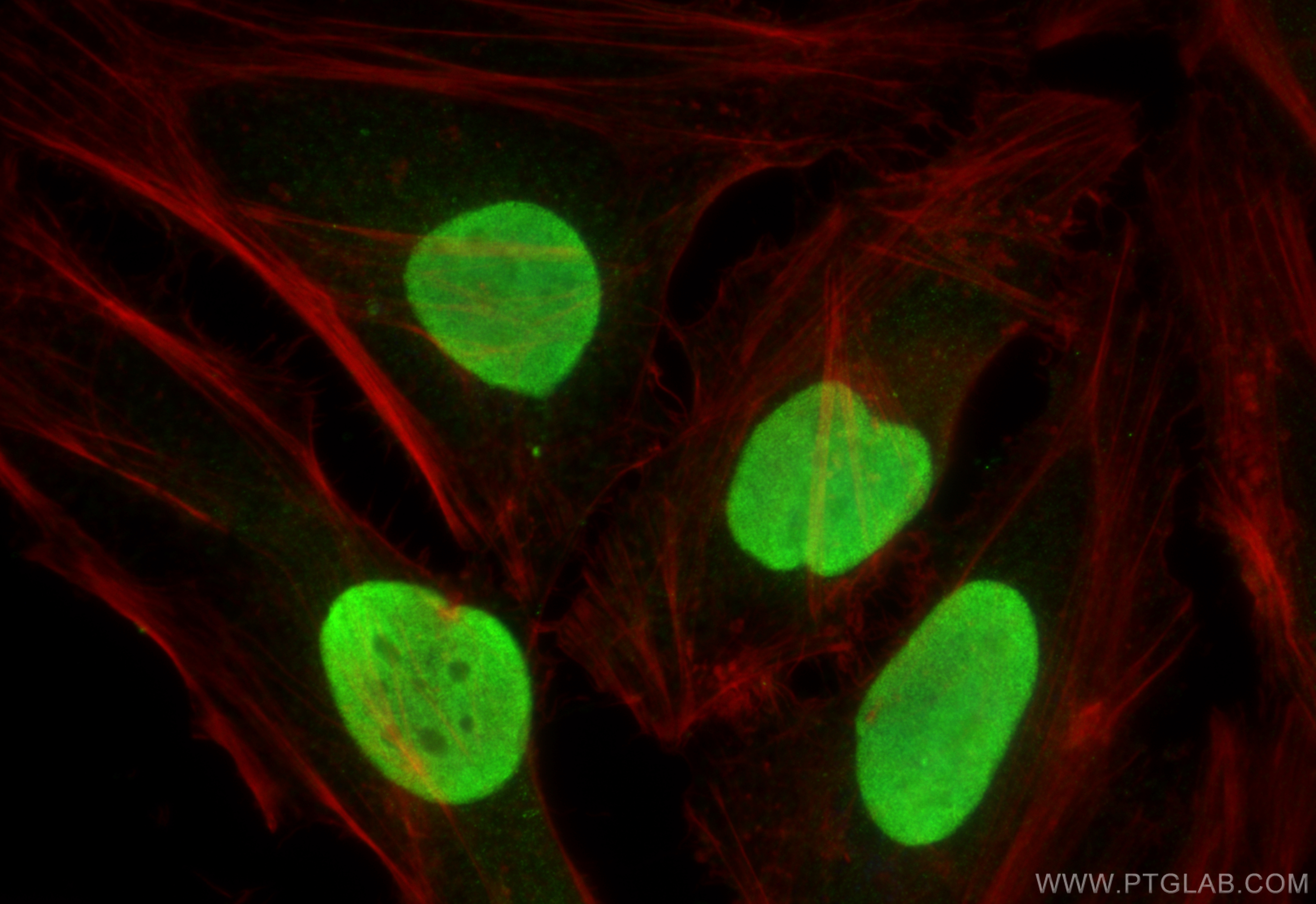 Immunofluorescence (IF) / fluorescent staining of HeLa cells using SUB1 Polyclonal antibody (11956-1-AP)