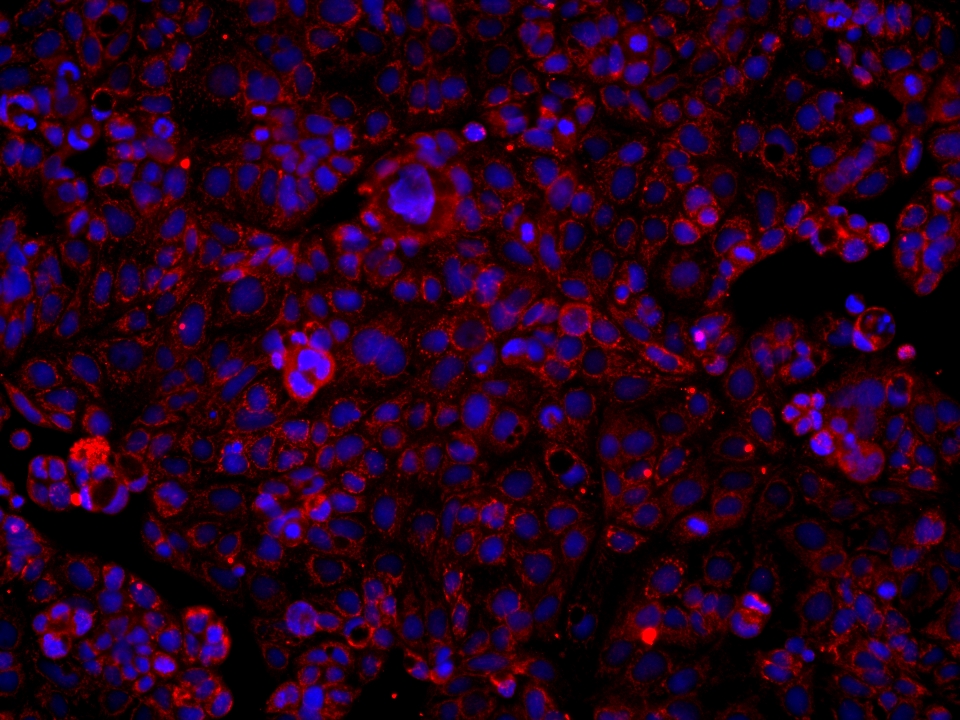 Immunofluorescence (IF) / fluorescent staining of Caco-2 cells using SUCLA2 Monoclonal antibody (68549-1-Ig)