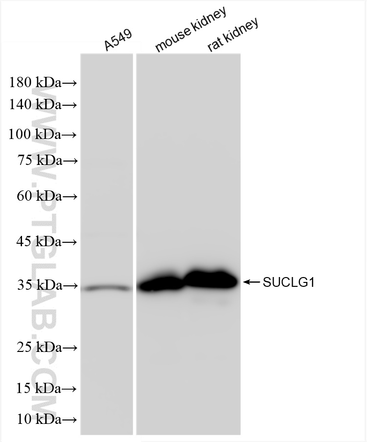 Western Blot (WB) analysis of various lysates using SUCLG1 Recombinant antibody (86072-1-RR)
