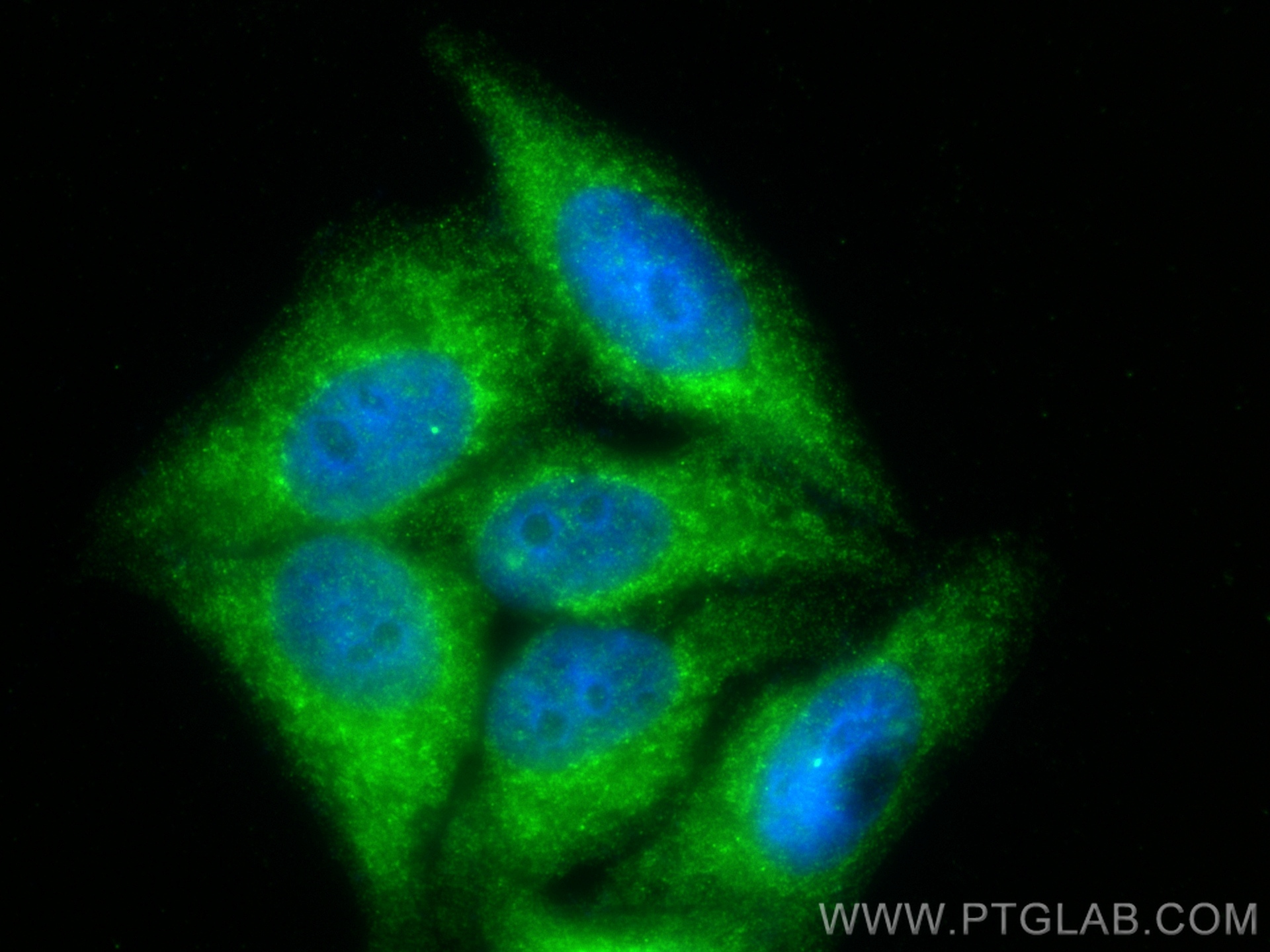 Immunofluorescence (IF) / fluorescent staining of HepG2 cells using SULT1A1 Polyclonal antibody (10911-2-AP)