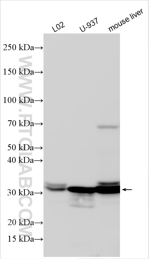 Western Blot (WB) analysis of various lysates using SULT1A1 Polyclonal antibody (10911-2-AP)