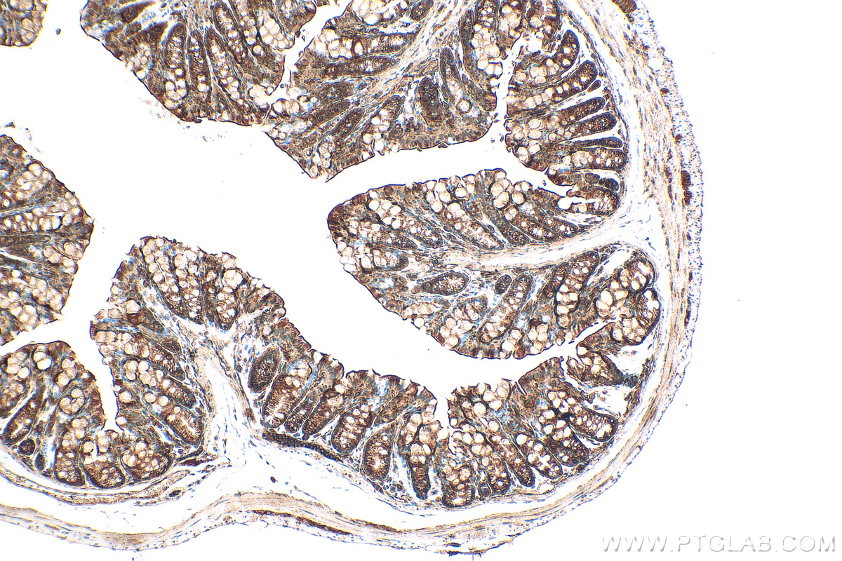 Immunohistochemistry (IHC) staining of mouse colon tissue using SULT1B1 Recombinant antibody (83228-1-RR)