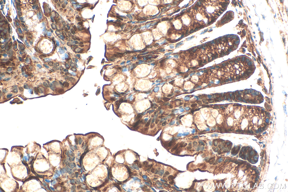 Immunohistochemistry (IHC) staining of mouse colon tissue using SULT1B1 Recombinant antibody (83228-1-RR)