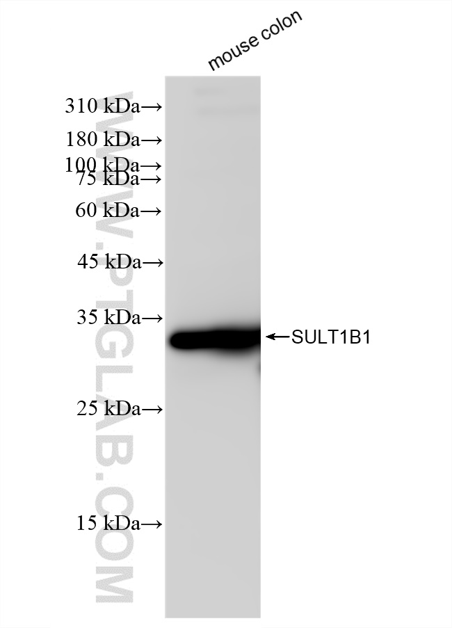 Western Blot (WB) analysis of mouse colon tissue using SULT1B1 Recombinant antibody (83228-1-RR)