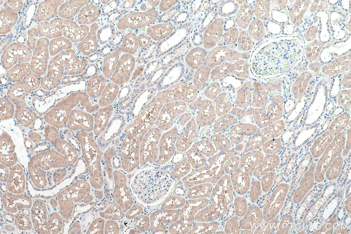 Immunohistochemistry (IHC) staining of human kidney tissue using SULT2A1 Polyclonal antibody (16348-1-AP)