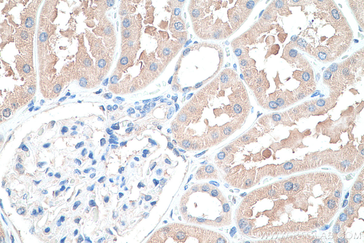 Immunohistochemistry (IHC) staining of human kidney tissue using SULT2A1 Polyclonal antibody (16348-1-AP)