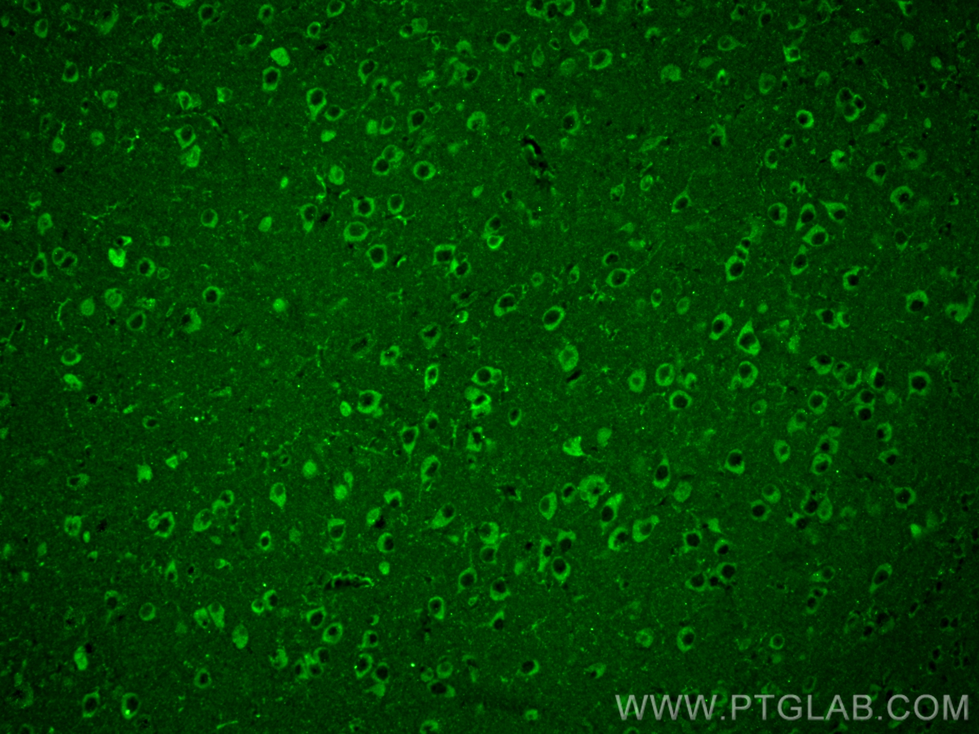 Immunofluorescence (IF) / fluorescent staining of mouse brain tissue using SULT4A1 Monoclonal antibody (66106-1-Ig)