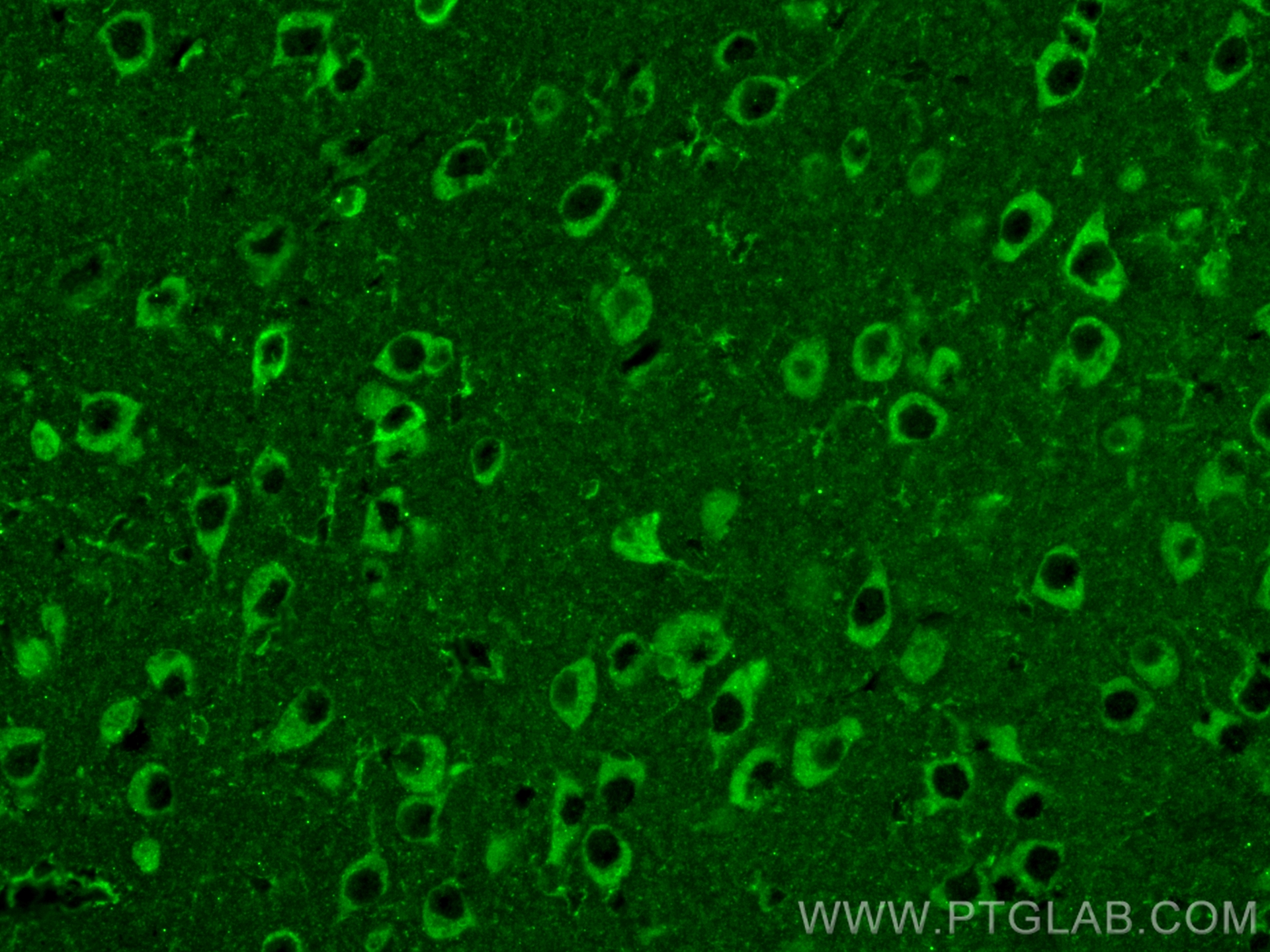 Immunofluorescence (IF) / fluorescent staining of mouse brain tissue using SULT4A1 Monoclonal antibody (66106-1-Ig)